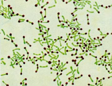 diphtheria bacillus