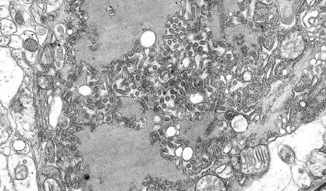 Фотография вируса бешенства под электронным микроскопом