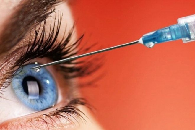 How to give an injection in the eye