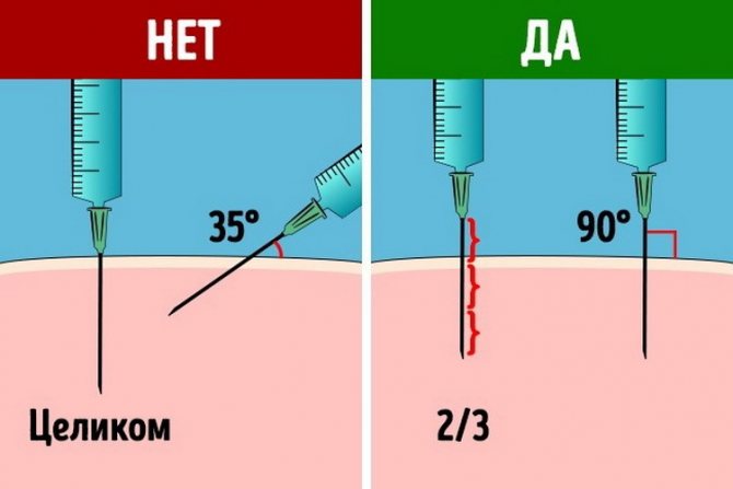 How to insert a needle correctly for intramuscular injection?