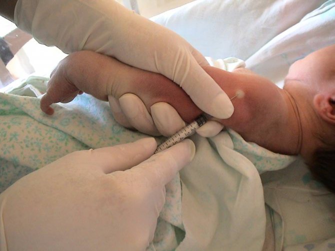 Where is BCG vaccination given to newborns?