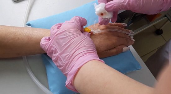 Connecting an IV to a peripheral venous catheter