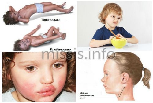 Consequences of measles vaccination