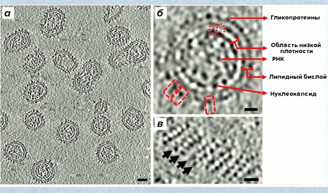 Visualization of rubella virus particles