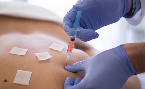 Intramuscular injection into the buttock